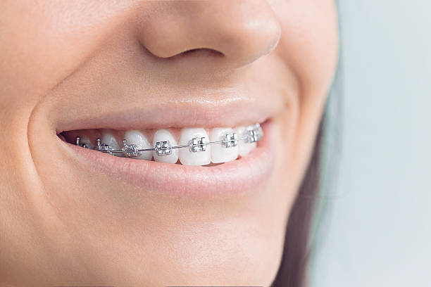 Best Full Mouth Reconstruction  in Paloma Creek, TX